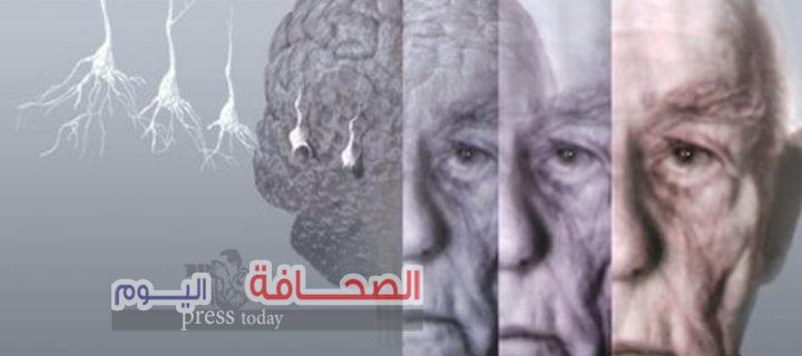 إكتشاف علاج جديد يقضى على مرض الزهايمر